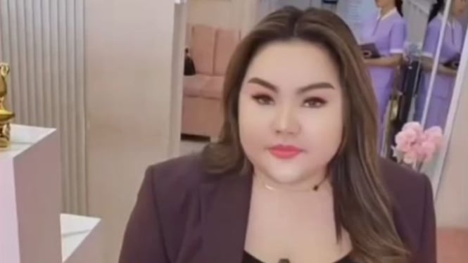 Lisa Mariana Tampil Gemuk: Janji Uang Perawatan Tak Tepati?