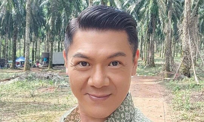 Peter Pang: Nyanyi Di Klub Demi Biaya Pengobatan Kanker